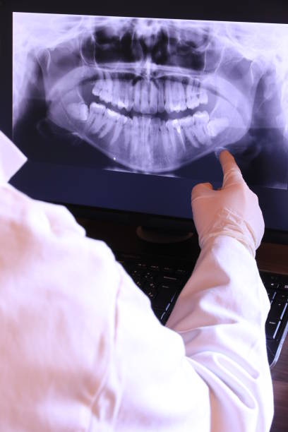 Best Chipped Tooth Repair Near Me  in Pompton Plains, NJ