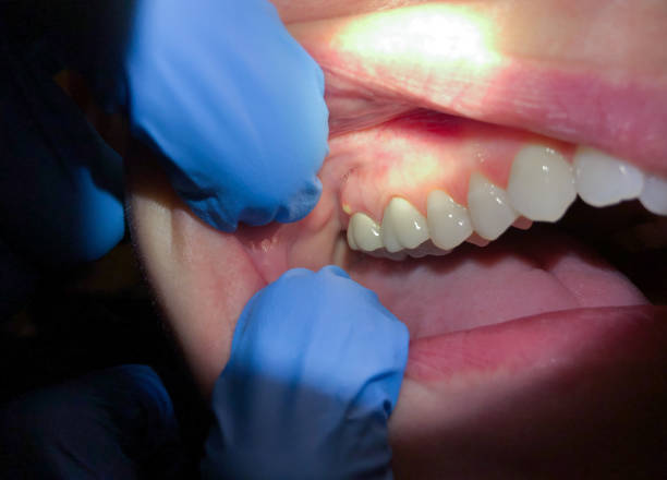 Best Urgent Tooth Repair  in Pompton Plains, NJ