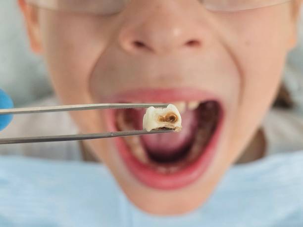 Best Emergency Tooth Extraction  in Pompton Plains, NJ